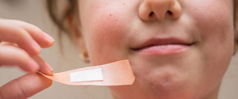 Usuwanie plasterków staje się znacznie prostsze!